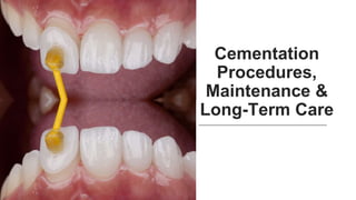 Cementation
Procedures,
Maintenance &
Long-Term Care
 