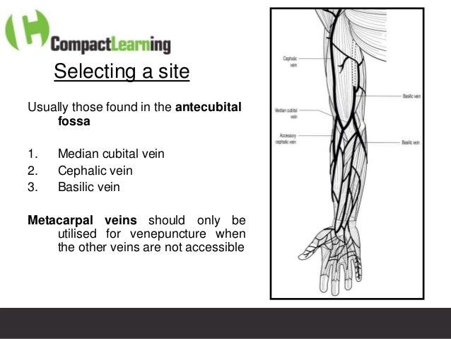 Venepuncture ad