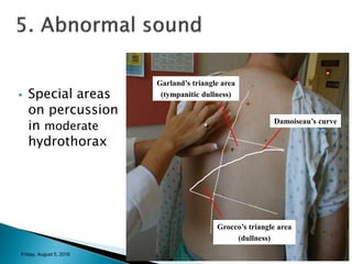 physical examination in RESPIRATORY SYSTEM | PPTX