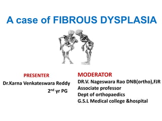 A case of FIBROUS DYSPLASIA
PRESENTER
Dr.Karna Venkateswara Reddy
2nd yr PG
MODERATOR
DR.V. Nageswara Rao DNB(ortho),FJR
Associate professor
Dept of orthopaedics
G.S.L Medical college &hospital
 