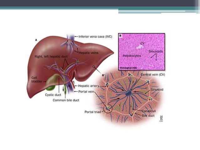 Veno occlusive disease