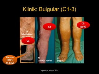 Antalya Ccpp Venoaktif ilaclar guncel endikasyonlar | PPTX