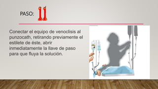 PASO:
Conectar el equipo de venoclisis al
punzocath, retirando previamente el
estilete de éste, abrir
inmediatamente la llave de paso
para que fluya la solución.
 