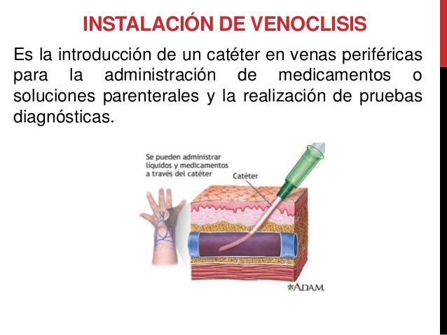 Venta celulares mexico - inhibidores para celulares