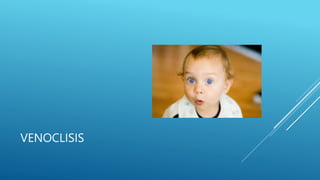 VENOCLISIS
 