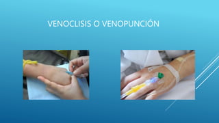 VENOCLISIS O VENOPUNCIÓN
 