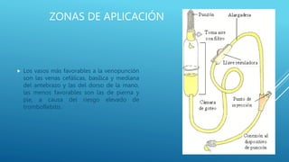 ZONAS DE APLICACIÓN
 Los vasos más favorables a la venopunción
son las venas cefálicas, basílica y mediana
del antebrazo y las del dorso de la mano,
las menos favorables son las de pierna y
pie, a causa del riesgo elevado de
tromboflebitis.
 