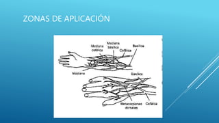 ZONAS DE APLICACIÓN
 