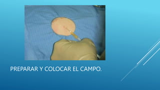 PREPARAR Y COLOCAR EL CAMPO.
 