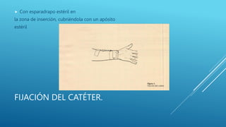 FIJACIÓN DEL CATÉTER.
 Con esparadrapo estéril en
la zona de inserción, cubriéndola con un apósito
estéril
 
