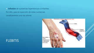 FLEBITIS
 Infusión de sustancias hipertónicas o irritantes.
Por ello, para la inyección de estas sustancias
canalizaremos una vía central.
 