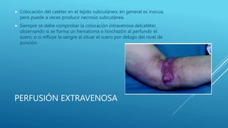 PERFUSIÓN EXTRAVENOSA
 Colocación del catéter en el tejido subcutáneo; en general es inocua,
pero puede a veces producir necrosis subcutánea.
 Siempre se debe comprobar la colocación intravenosa delcatéter,
observando si se forma un hematoma o hinchazón al perfundir el
suero, o si refluye la sangre al situar el suero por debajo del nivel de
punción.
 