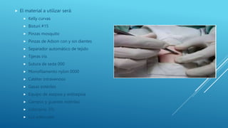  El material a utilizar será:
 Kelly curvas
 Bisturí #15
 Pinzas mosquito
 Pinzas de Adson con y sin dientes
 Separador automático de tejido
 Tijeras iris
 Sutura de seda 000
 Monofilamento nylon 0000
 Catéter intravenoso
 Gasas estériles
 Equipo de asepsia y antisepsia
 Campos y guantes estériles
 Lidocaína .5%
 Luz adecuada
 