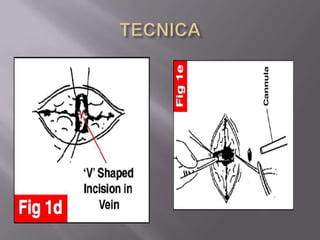 TECNICA 