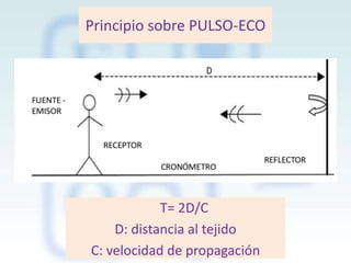Principio sobre PULSO-ECO

T= 2D/C
D: distancia al tejido
C: velocidad de propagación

 