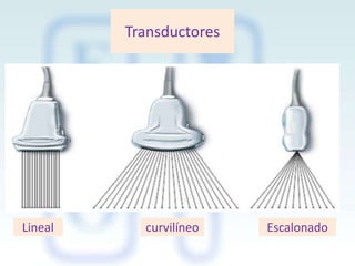Transductores

Lineal

curvilíneo

Escalonado

 