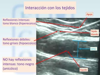 Interacción con los tejidos
Aguja

Reflexiones intensas:
tono blanco (hiperecoico)
Tejido
blando

Reflexiones débiles:
tono grises (hipoecoico)
vena

NO hay reflexiones
intensas: tono negro
(anicóico)

liquido

 