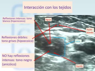 Interacción con los tejidos
Reflexiones intensas: tono
blanco (hiperecoico)

Aguja

Tejido
blando

Reflexiones débiles:
tono grises (hipoecoico)

vena

NO hay reflexiones
intensas: tono negro
(anicóico)

liquido

 