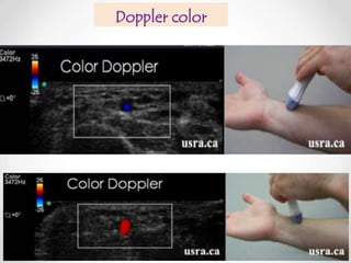 Doppler color

 