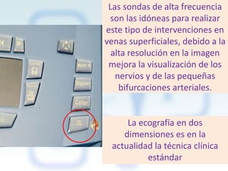 Las sondas de alta frecuencia
son las idóneas para realizar
este tipo de intervenciones en
venas superficiales, debido a la
alta resolución en la imagen
mejora la visualización de los
nervios y de las pequeñas
bifurcaciones arteriales.

La ecografía en dos
dimensiones es en la
actualidad la técnica clínica
estándar

 
