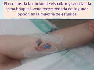 El eco nos da la opción de visualizar y canalizar la
vena braquial, vena recomendada de segunda
opción en la mayoría de estudios,

 