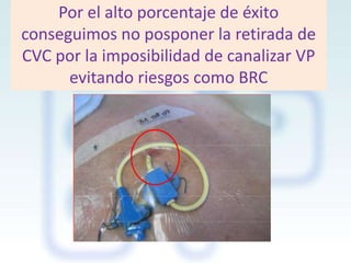 Por el alto porcentaje de éxito
conseguimos no posponer la retirada de
CVC por la imposibilidad de canalizar VP
evitando riesgos como BRC

 