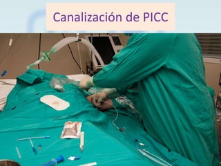 Canalización de PICC

 