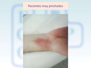 Pacientes muy pinchados

 