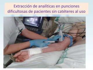 Extracción de analíticas en punciones
dificultosas de pacientes sin catéteres al uso

 