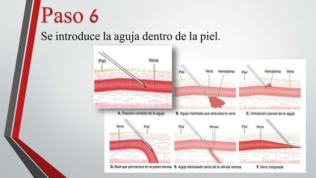 Venopuncion | PPTX