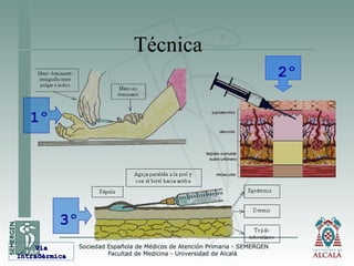 Técnica
1º
2º
3º
VíaVía
IntradérmicaIntradérmica
 