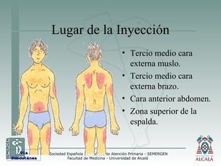 Lugar de la Inyección
• Tercio medio cara
externa muslo.
• Tercio medio cara
externa brazo.
• Cara anterior abdomen.
• Zona superior de la
espalda.
VíaVía
SubcutáneaSubcutánea
 