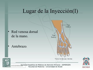 Lugar de la Inyección(I)
• Red venosa dorsal
de la mano.
• Antebrazo.
Vía intravenosa
 