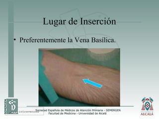 Lugar de Inserción
• Preferentemente la Vena Basílica.
Vía intravenosa
 