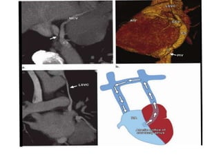 venous anomalies Dr Nikhil.pptx