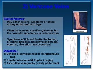 2) Varicose Veins Clinical features: May either give no symptoms or cause aching & discomfort in legs.  Often there are no specific symptoms but the cosmetic appearance is unsatisfactory. Symptoms of itch and & skin thickening , bleeding, phlebitis, lipodermatosclerosis, eczema , ulceration may be present. Diagnosis :  1) Clinical  (Tourniquet test or Trendelenburg test).  2) Doppler ultrasound & Duplex imaging  3) Ascending venography ( rarely performed)   