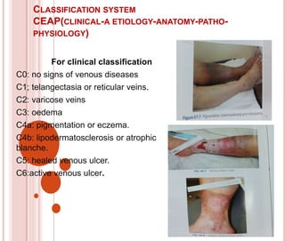 VENOUS DISORDERS AND MANAGMENT 4400.pptx