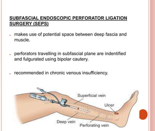 Fulgurated VENOUS DISORDERS AND MANAGMENT 4400.pptx