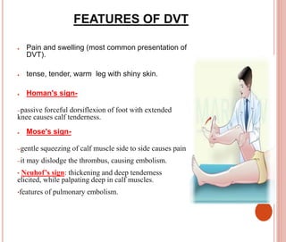 VENOUS DISORDERS AND MANAGMENT 4400.pptx
