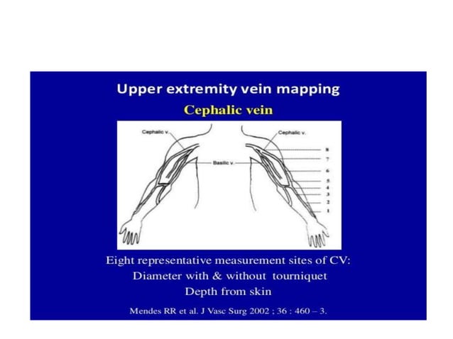 Venous Doppler upper limb | PPTX