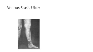 VENOUS Dranage of the lower linb anatomy .pdf