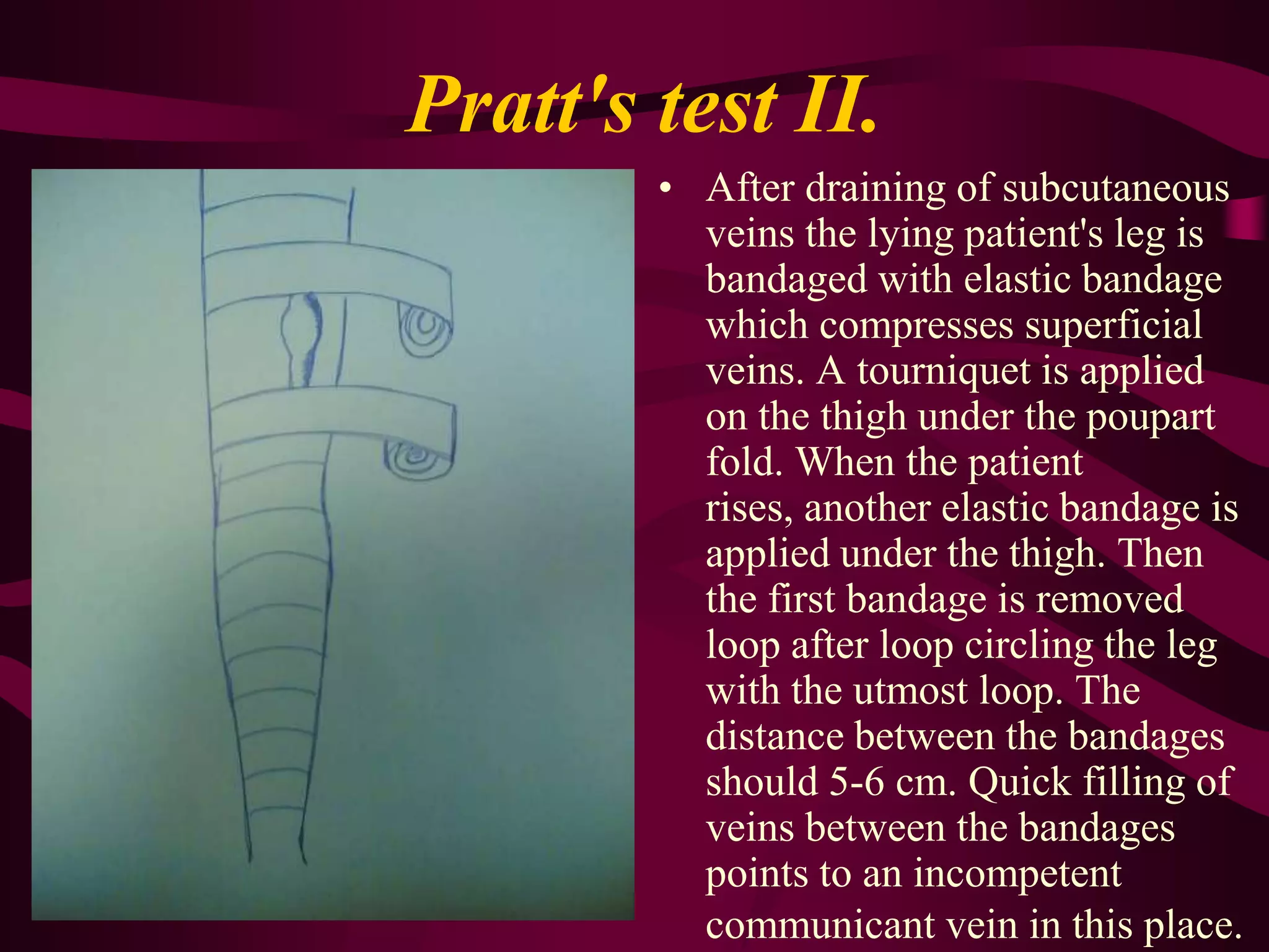 Trophic ulcerUlcers caused by venous circulation disorder typically develop on the inner surface of lower third of shin, above the ankle. The ulcers are usually single, flat, with an even bottom; their borders are irregular, abrupt; the discharge is scarce, serous or purulent. If infection develops, ulcers become painful. Around the ulcer hemosiderosis and induration of subcutaneous fat develop.