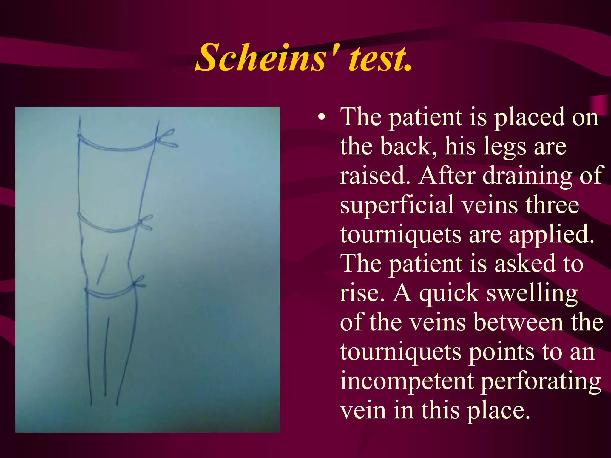 Main symptoms of thrombophlebitis of profoundveinsEdema of the extremity The pains are localised in the gastrocnemius muscles as a rule, along the course of vascular bundlesThe skin of the extremity becomes cyanotic.