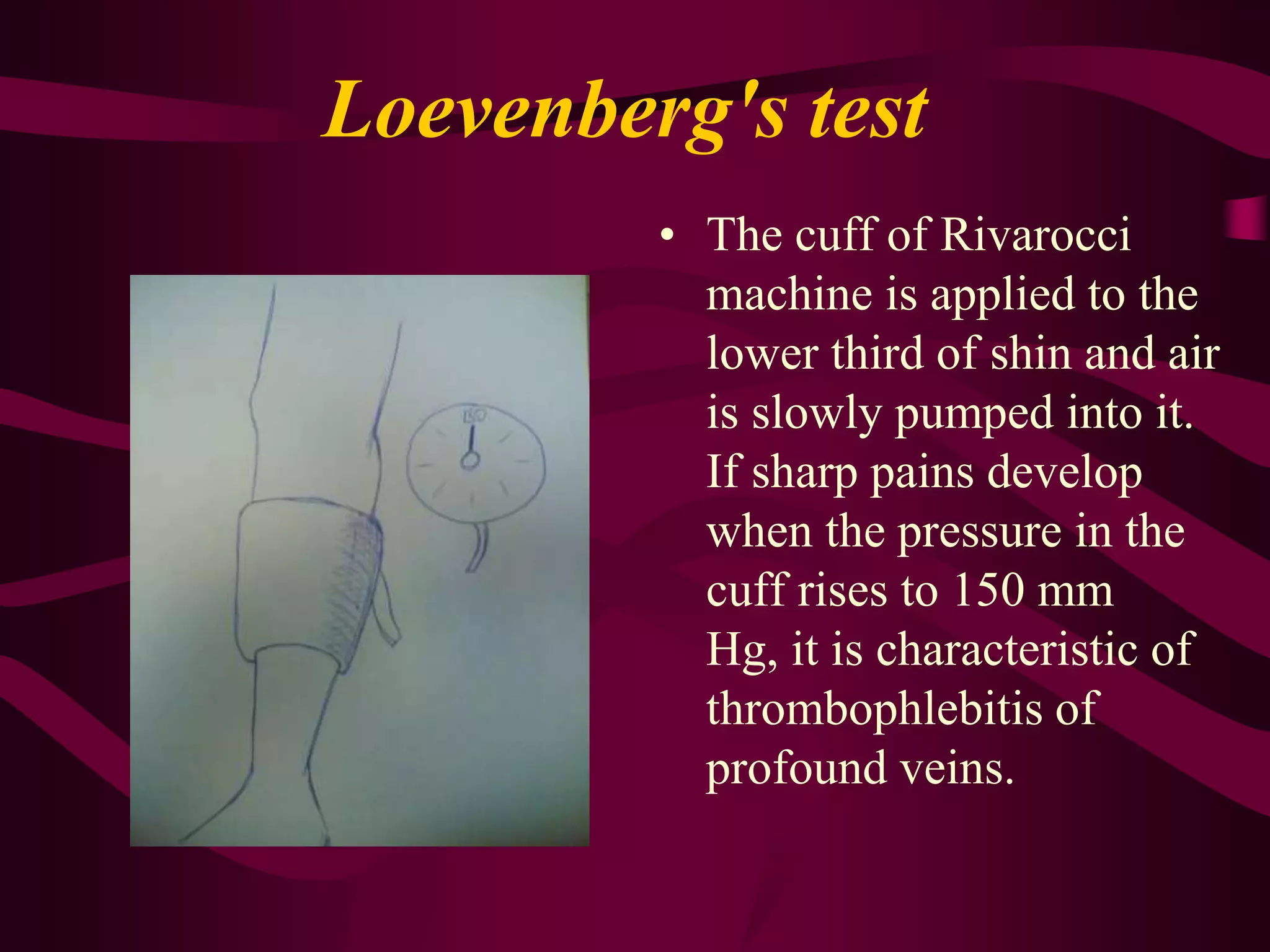 Trendelenburg-Trojanov's test.The patient lying on his back raises one leg. When blood has drained from superficial veins, the greater subcutaneous vein is compressed in the place where it joins the femoral vein and keeping the finger there the patient is asked to rise. If venous trunks swell quickly when the finger is removed, we can conclude that the ostial valve is incompetent.