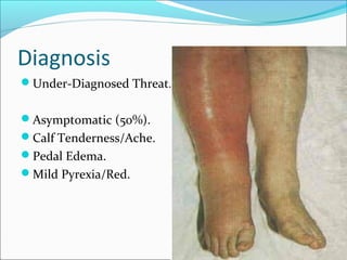 Pyrexia Red Rashes Venous insufficiency dvt - final year mbbs lecture | PPT