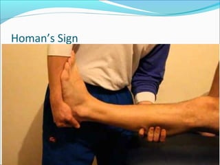 Signe Homans Venous insufficiency dvt - final year mbbs lecture | PPT