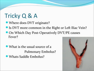 Venous insufficiency dvt - final year mbbs lecture | PPT