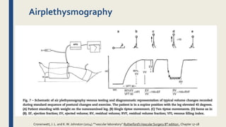 Airplethysmography
Cronenwett, J. L. and K.W. Johnston (2014).””vascular laboratory” Rutherford'sVascular Surgery 8th edition , Chapter 17-18
 