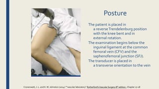 Posture
The patient is placed in
a reverseTrendelenburg position
with the knee bent and in
external rotation.
The examination begins below the
inguinal ligament at the common
femoral vein (CFV) and the
saphenofemoral junction (SFJ).
The transducer is placed in
a transverse orientation to the vein
Cronenwett, J. L. and K.W. Johnston (2014).””vascular laboratory” Rutherford'sVascular Surgery 8th edition , Chapter 17-18
 