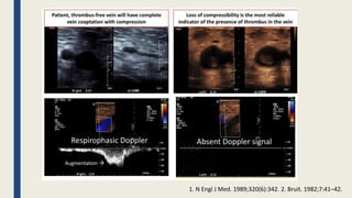 1. N Engl J Med. 1989;320(6):342. 2. Bruit. 1982;7:41–42.
 